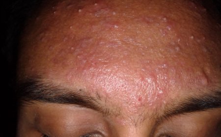 Common Skin Issues in Nigeria